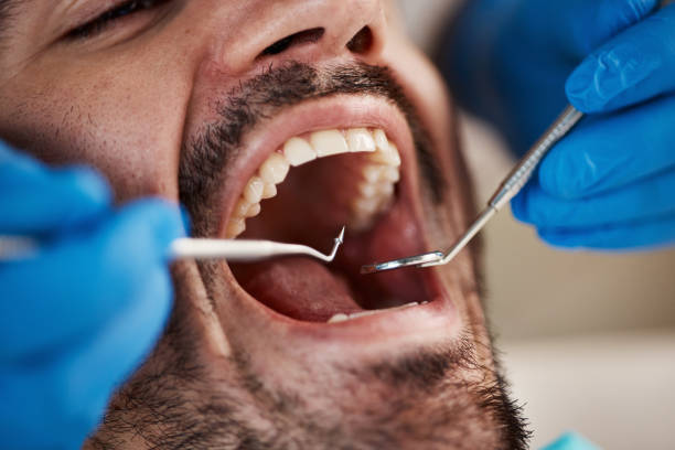 Best Emergency Dental Care for Sports Injuries in Zephyrhills North, FL