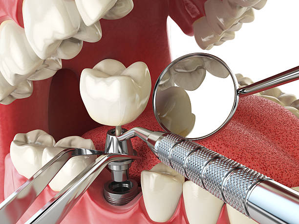 Best Emergency Root Canal Therapy in Zephyrhills North, FL