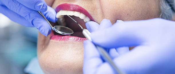Best Dental Abscess Treatment in Zephyrhills North, FL